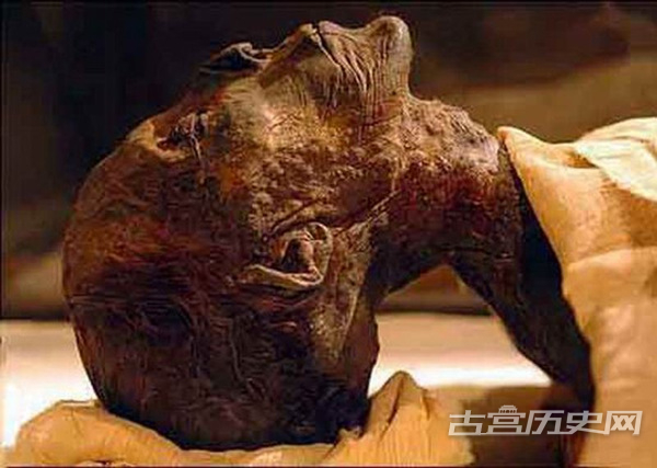 哈特谢普苏特之手 2007年，埃及国王谷发现一具3500年前的木乃伊尸体，经鉴定她是着名的女法老哈特谢普苏特，理想化的雕塑形象显示这位强势女性统治者戴有假胡须，并遮盖住自己的胸部。通过对她的尸体分析显示她生前患有糖尿病和关节炎，很可能因骨癌死亡。从表面上看，她体形肥胖，牙齿状态不好。虽然她的继承者试图抹杀她统治时期的所有记录，但她的木乃伊尸体仍隐藏着非常好，一直保护了下来。哈特谢普苏特的尸体被细致地包裹起来，尸体保存状况较好，至今仍能清晰地看到弯曲左手指甲上涂有红色颜料，手指边缘涂有黑色颜料。