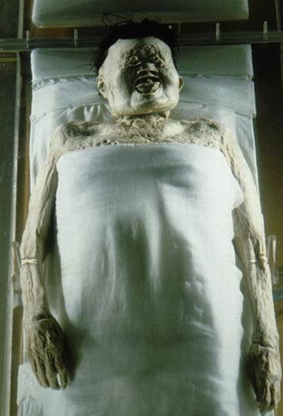 中国汉朝马王堆辛追夫人 如图，这是中国长沙马王堆出土的辛追夫人尸体，她生活在2000多年前汉朝时期，丈夫是长沙丞相轪侯利苍，辛追夫人死亡年龄大约为50岁。她的尸体被20多层精品丝绸包裹着，浸入“长生不老药”，放置在四具棺材之中，周围环绕着5吨木炭，整体墓室位于地下50英尺处。这种尸体保存状态是非常令人惊奇的，辛追夫人的尸体被称为迄今所见干尸中保存最完好，甚至尸体中的血液仍处于液态，器官仍完整无损，四肢仍具有弹性。